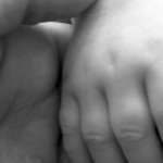 cisti alle mani