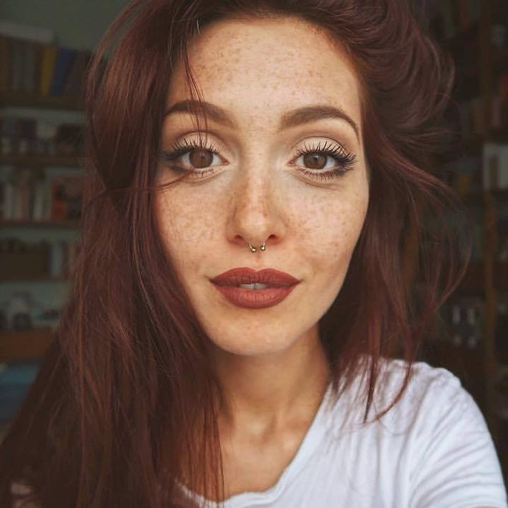 Lentiggini cosa sono e come curare