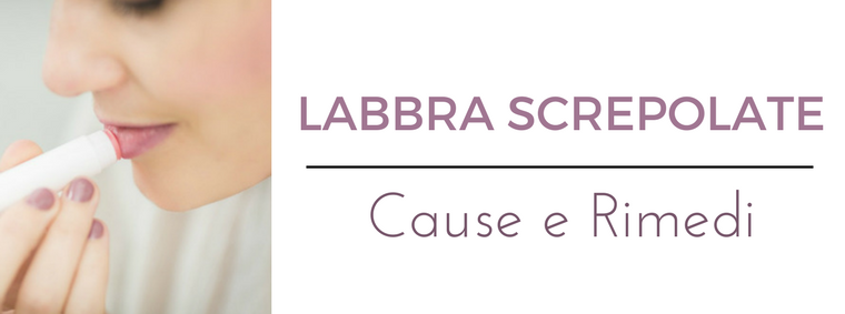 Labbra secche e screpolate: consulto online del migliore dermatologo a Milano all'Istituto Dermoclinico Vita Cutis Plinio